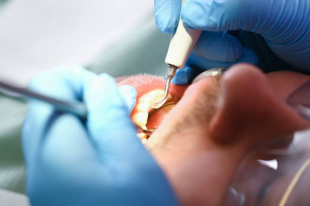 Best Emergency Dental Care for Trauma or Injury in Rapid City, MI