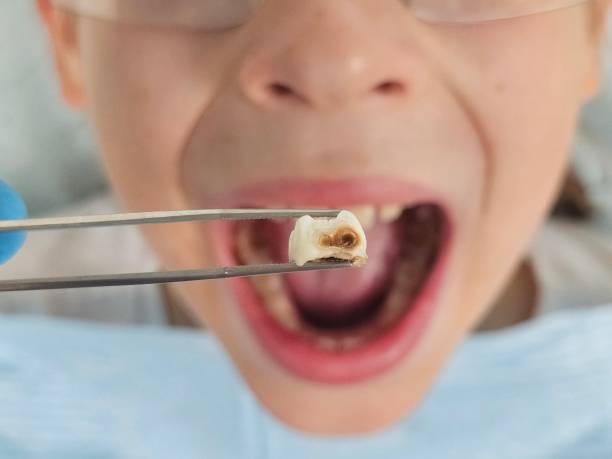 Best Emergency Dental Surgery in Rapid City, MI