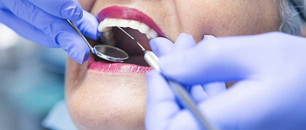 Best Emergency Root Canal Treatment in Rapid City, MI